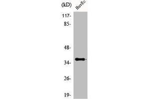 Western Blot analysis of HuvEc cells using ACOT8 Polyclonal Antibody (ACOT8 antibody  (Internal Region))