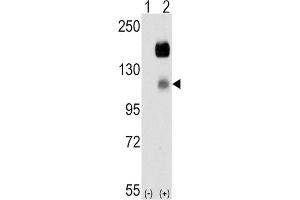 Western Blotting (WB) image for anti-PTK7 Protein tyrosine Kinase 7 (PTK7) antibody (ABIN3003499)