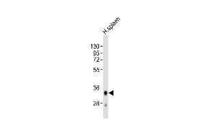 Anti-HLA-DQA1 Antibody (C-term)at 1:2000 dilution + human spleen lysates Lysates/proteins at 20 μg per lane.