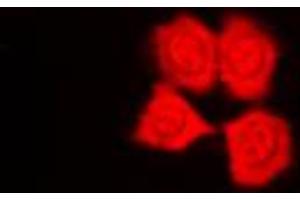 Immunofluorescent analysis of PKN1 staining in HepG2 cells. (PKN1 antibody  (Center))