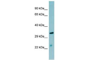 WB Suggested Anti-MASP2 Antibody Titration:  0. (MASP2 antibody  (N-Term))