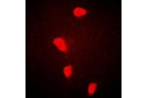 Immunofluorescent analysis of FHL-1 staining in Hela cells. (FHL1 antibody)