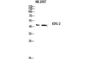 Western Blot (WB) analysis of KB 293T lysis using EDG-2 antibody.