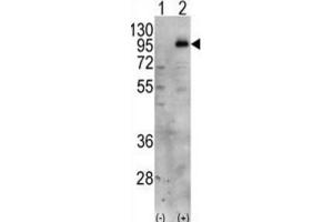 Western Blotting (WB) image for anti-Phosphatidylinositol-4-Phosphate 5-Kinase, Type I, gamma (PIP5K1C) antibody (ABIN3003648) (PIP5K1C antibody)