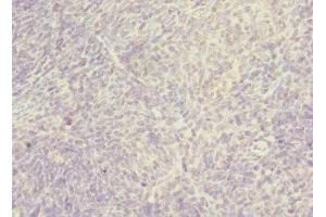 Immunohistochemistry of paraffin-embedded human thymus tissue using ABIN7170393 at dilution of 1:100 (SNX32 antibody  (AA 144-403))