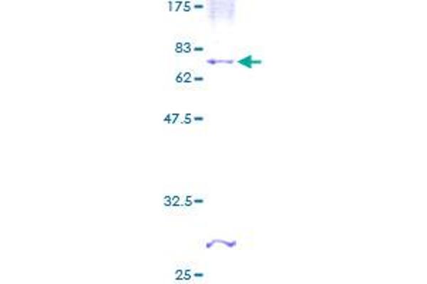 CHST4 Protein (AA 1-370) (GST tag)