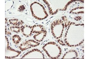 Image no. 2 for anti-Adipocyte Plasma Membrane Associated Protein (APMAP) antibody (ABIN1496662) (APMAP antibody)