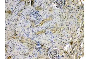 Immunohistochemistry (IHC) image for anti-Purine Nucleoside Phosphorylase (PNP) (AA 161-189) antibody (ABIN5647213)