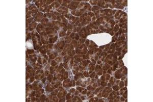 Immunohistochemistry (Formalin/PFA-fixed paraffin-embedded sections) of human pancreas with STX5 polyclonal antibody  shows strong cytoplasmic positivity in exocrine glandular cells. (Syntaxin 5 antibody)