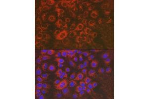 Immunofluorescence analysis of Huh7 cells using Sorbitol Dehydrogenase Rabbit pAb (ABIN3022961, ABIN3022962, ABIN3022963, ABIN1513552 and ABIN6219319) at dilution of 1:50 (40x lens). (SORD antibody  (AA 1-357))