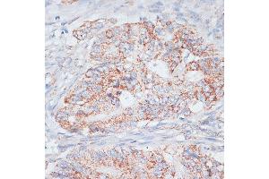 Immunohistochemistry (IHC) image for anti-Desmoplakin (DSP) (AA 1-100) antibody (ABIN6139838)