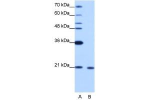 RBM8A antibody used at 1. (RBM8A antibody  (N-Term))
