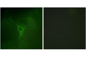 Immunofluorescence analysis of COS7 cells, using GFAP (Phospho-Ser38) Antibody. (GFAP antibody  (pSer38))
