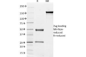 SDS-PAGE Analysis Purified CD51 / Integrin 'V Mouse Monoclonal Antibody (ITGAV/1610). (CD51 antibody)
