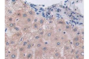 Detection of ETFb in Human Liver Tissue using Polyclonal Antibody to Electron Transfer Flavoprotein Beta Polypeptide (ETFb) (ETFB antibody  (AA 2-255))