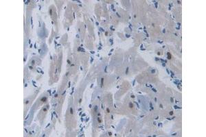 #VALUE! (TOP3B antibody  (AA 1-250))