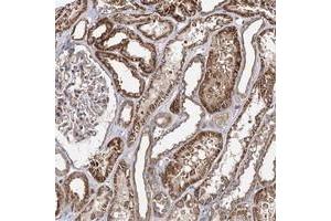 Immunohistochemical staining of human kidney with SEC24B polyclonal antibody  shows strong cytoplasmic positivity in cells in tubules at 1:200-1:500 dilution. (SEC24B antibody)