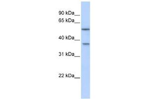 RAB40B antibody used at 1 ug/ml to detect target protein. (RAB40B antibody  (Middle Region))