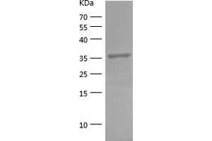 Western Blotting (WB) image for Fructose-1,6-Bisphosphatase 1 (FBP1) (AA 199-338) protein (His-IF2DI Tag) (ABIN7282178) (FBP1 Protein (AA 199-338) (His-IF2DI Tag))