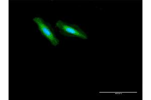 Immunofluorescence of purified MaxPab antibody to GCDH on HeLa cell. (GCDH antibody  (AA 1-438))
