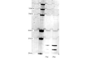TFAM antibody - N-terminal region  validated by WB using bEND3 cell lysate at lane1:10 ug, lane2:20 ug.