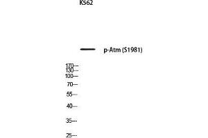 Western Blot (WB) analysis of K562 using p-Atm (S1981) antibody. (ATM antibody  (pSer1981))