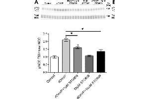 Ex vivo studies on isolated cortical tubules from mouse kidney highlight a role for CAMKK and PI3K in VP signaling in mpkDCT cells. (SLC12A3 antibody  (AA 74-95))