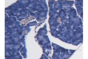 DAB staining on IHC-P; Samples: Mouse Pancreas Tissue (BCAT1 antibody  (AA 158-386))