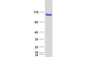 Validation with Western Blot (FE65 Protein (Transcript Variant 2) (Myc-DYKDDDDK Tag))