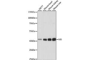 Western blot analysis of extracts of various cell lines, using IVD antibody (ABIN7268031) at 1:1000 dilution. (IVD antibody  (AA 33-200))