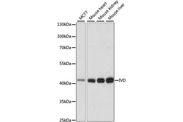 IVD antibody  (AA 33-200)