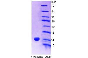 SDS-PAGE analysis of Human S100A9 Protein.