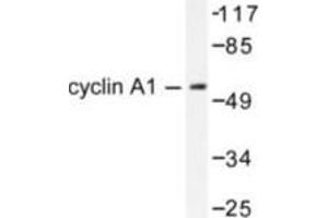 Image no. 2 for anti-Cyclin A1 (CCNA1) antibody (ABIN265378) (Cyclin A1 antibody)