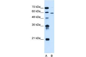 WB Suggested Anti-ALG11 Antibody Titration:  0. (ALG11 antibody  (C-Term))