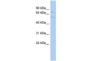 WB Suggested Anti-ZNF285A Antibody Titration:  0. (ZNF285 antibody  (Middle Region))