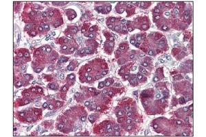 Immunohistochemistry (IHC) image for anti-Protease, serine, 1 (Trypsin 1) (PRSS1) antibody (ABIN614514) (PRSS1 antibody)