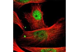 Immunofluorescence staining of U-251MG cell line with antibody shows positivity in nucleoplasm(green). (PBX1 antibody)