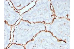 Formalin-fixed, paraffin-embedded human small intestine stained with ACE / CD143 Mouse Monoclonal Antibody (9B9).