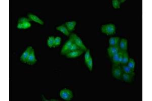 Immunofluorescent analysis of HepG2 cells using ABIN7173954 at dilution of 1:100 and Alexa Fluor 488-congugated AffiniPure Goat Anti-Rabbit IgG(H+L) (INPP5A antibody  (AA 1-409))