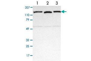 Western blot analysis of Lane 1: Human cell line RT-4 Lane 2: Human cell line EFO-21 Lane 3: Human cell line A-431 with NEK9 polyclonal antibody  at 1:250-1:500 dilution. (NEK9 antibody)