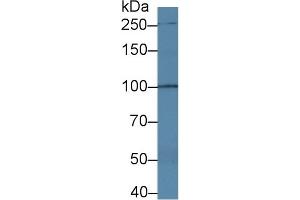 Western Blotting (WB) image for anti-Transient Receptor Potential Cation Channel, Subfamily C, Member 6 (TRPC6) (AA 1-192) antibody (ABIN7441304)