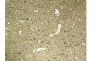 Image no. 3 for anti-Microtubule-Associated Protein tau (MAPT) (pSer404) antibody (ABIN196810) (MAPT antibody  (pSer404))