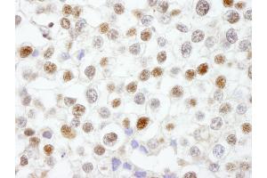 Immunohistochemistry (IHC) image for anti-Flap Structure-Specific Endonuclease 1 (FEN1) (AA 250-300) antibody (ABIN7448564)