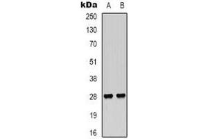 Western blot analysis of VEGI expression in Hela (A), NIH3T3 (B) whole cell lysates. (TNFSF15 antibody)