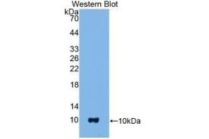 Detection of Recombinant S100B, Mouse using Polyclonal Antibody to S100 Calcium Binding Protein B (S100B) (S100B antibody  (AA 1-92))