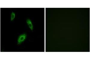 Immunofluorescence analysis of LOVO cells, using GPR174 Antibody. (GPR174 antibody  (AA 131-180))