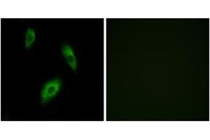Immunofluorescence analysis of LOVO cells, using GPR174 Antibody. (GPR174 antibody  (AA 131-180))