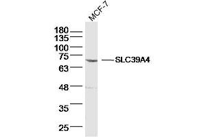 MCF-7 lysates probed with SLC39A4 Polyclonal Antibody, Unconjugated  at 1:300 dilution and 4˚C overnight incubation. (SLC39A4 antibody  (AA 281-380))