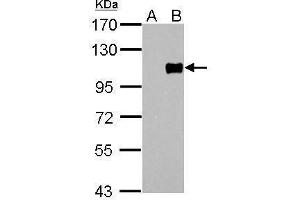 WB Image FOXM1 antibody [C3], C-term detects FOXM1 protein by Western blot analysis. (FOXM1 antibody  (C-Term))