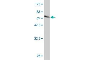 Western Blot detection against Immunogen (67. (Hepsin antibody  (AA 40-417))